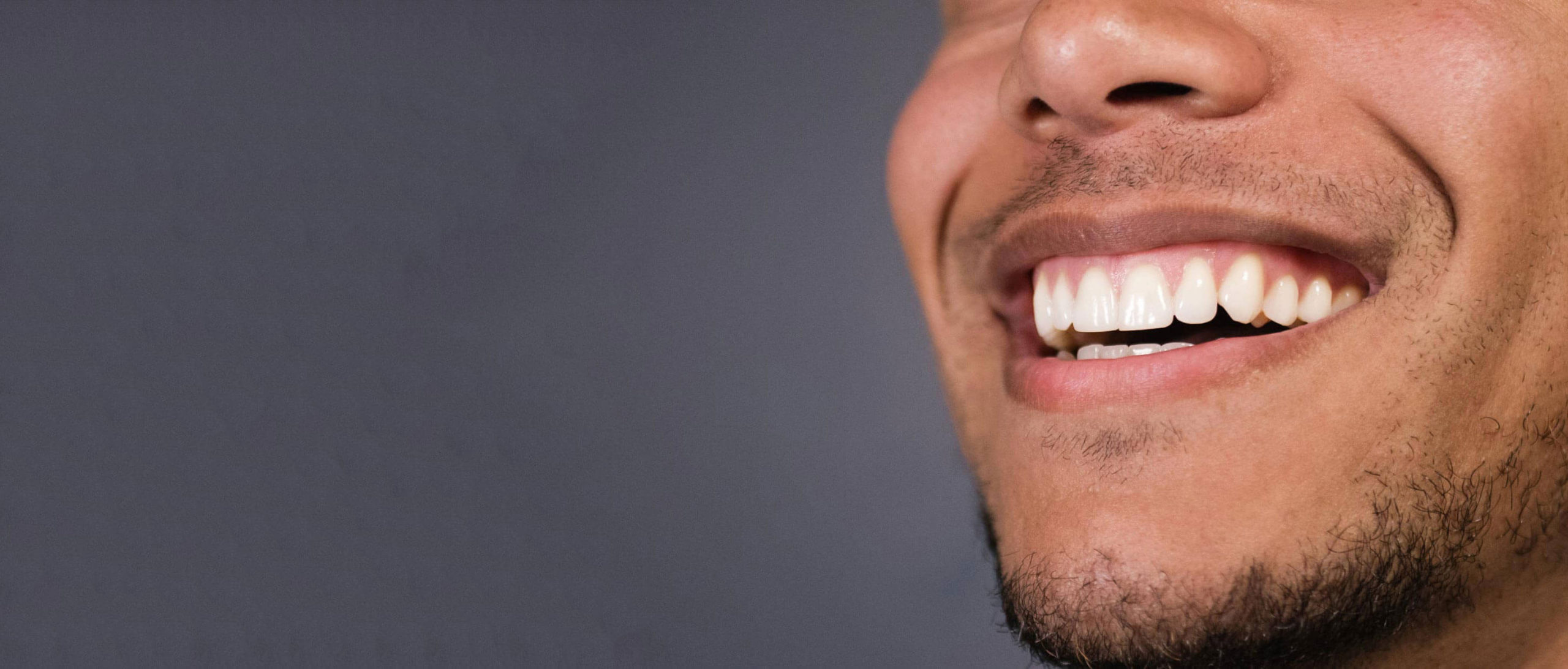 gummysmiletreatmentaesthetics-uk Gummy Smile treatment